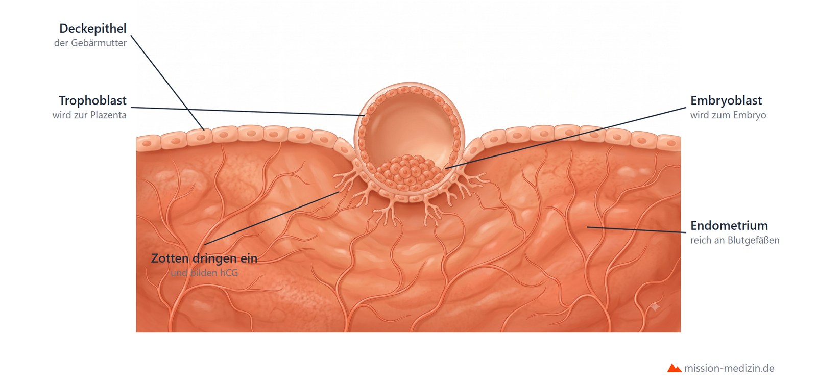 Blastozyste nistet sich in die Gebärmutterschleimhaut ein, der Trophoblast dringt mit Zotten in das gefäßreiche Endometrium vor